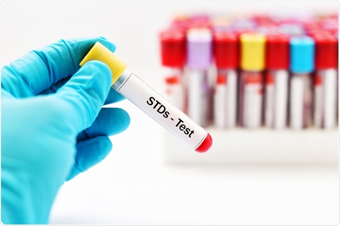 Std